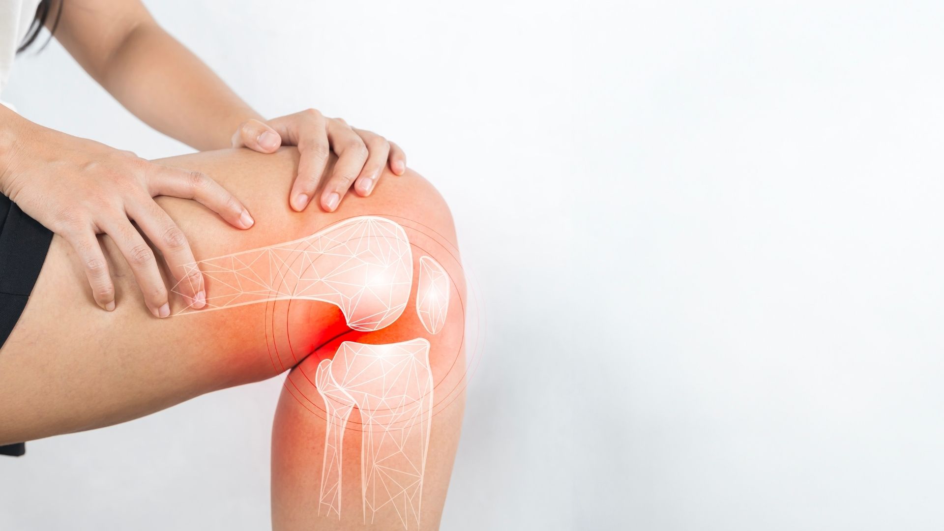 knee oa