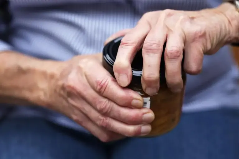 Hand and finger arthritis