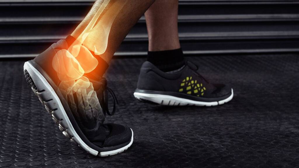 Ankle pain