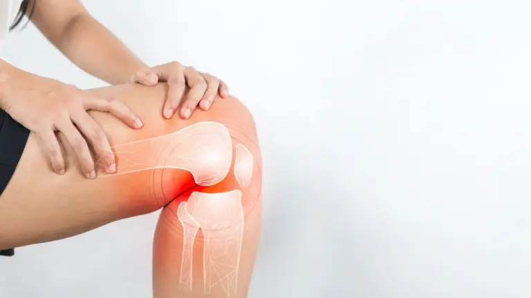 Knee Arthritis